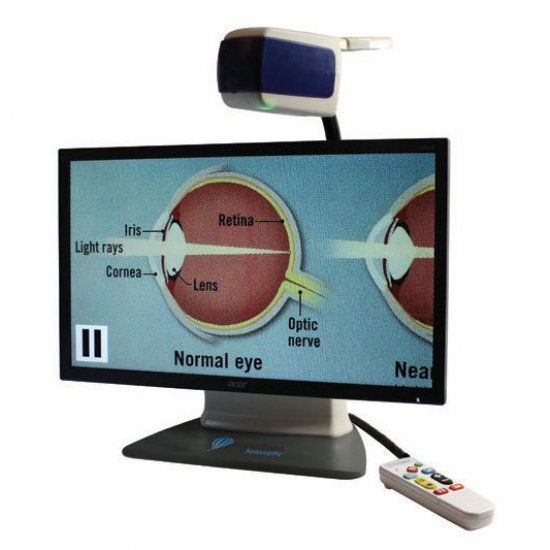 Onyx Deskset Video Magnifier